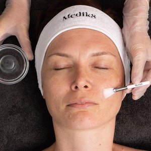 Medik8 schoonheidssalon gezichtsbehandeling peeling 12weektowow schoonheidssalon lienden